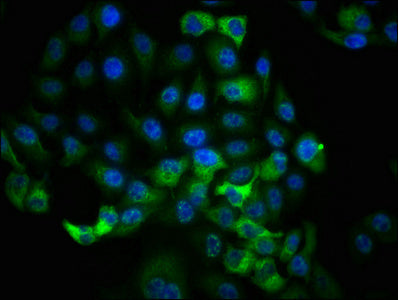 Phospho-RPS6KA1 (T359+S363) Antibody