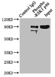 Phospho-RPS6KA1 (T359+S363) Antibody
