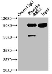 Phospho-RPS6KA1 (S380) Antibody