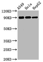 Phospho-RPS6KA1 (S380) Recombinant Monoclonal Antibody