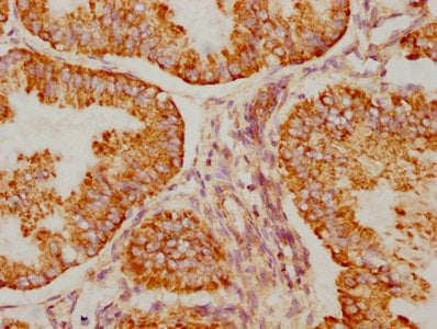 BAK1 Antibody