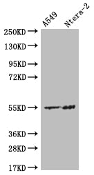 HMGCS2 Recombinant Monoclonal Antibody