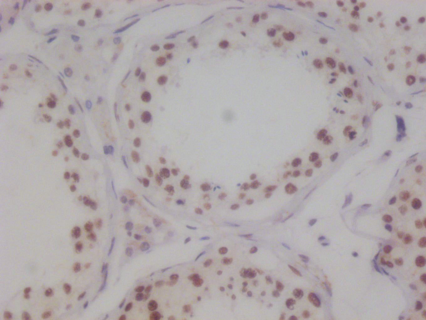 KAT8 Recombinant Monoclonal Antibody
