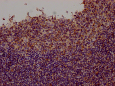 FYN Recombinant Monoclonal Antibody