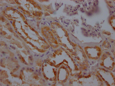 F3 Antibody