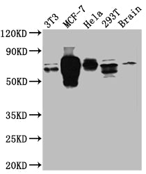 RPS6KB1 Recombinant Monoclonal Antibody