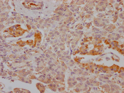 FBP1 Recombinant Monoclonal Antibody