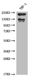 ITGAL Recombinant Monoclonal Antibody