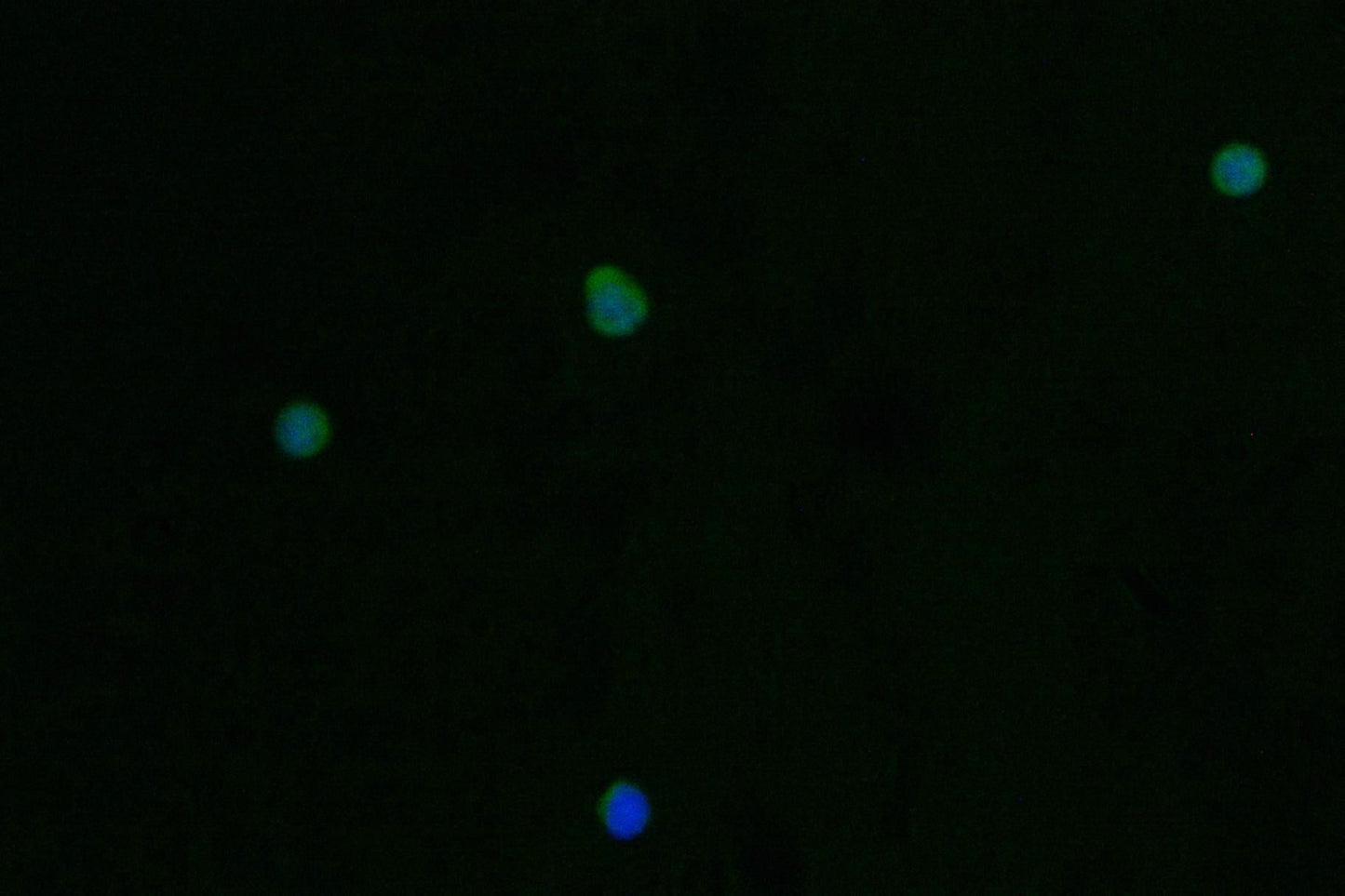 PRSS2 Recombinant Monoclonal Antibody