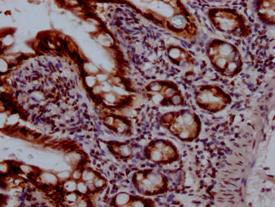 TOP1 Antibody