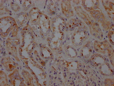 LRRK2 Recombinant Monoclonal Antibody