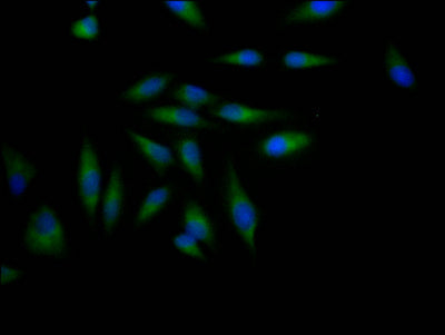 ADAM17 Recombinant Monoclonal Antibody