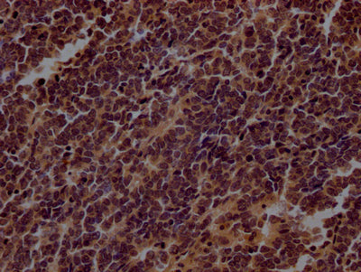 TERT Recombinant Monoclonal Antibody