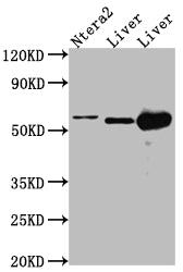 ALDH2 Recombinant Monoclonal Antibody
