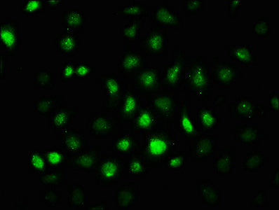 Phospho-PRKAA2 (Thr172) Antibody