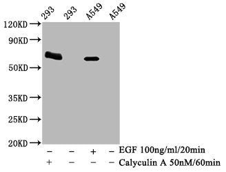 Phospho-PRKAA2 (Thr172) Recombinant Monoclonal Antibody