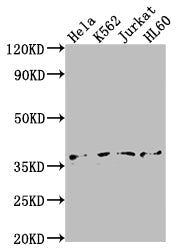 TBP Recombinant Monoclonal Antibody