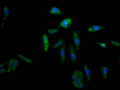 AKR1C3 Recombinant Monoclonal Antibody