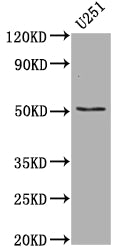 TP53 Recombinant Monoclonal Antibody