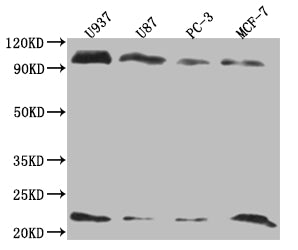 LMO2 Recombinant Monoclonal Antibody