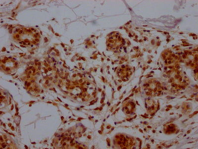 E2F1 Antibody