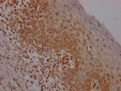 E2F1 Antibody