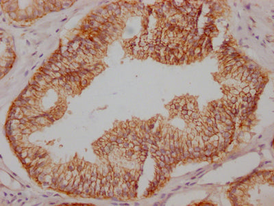 SNAP23 Recombinant Monoclonal Antibody