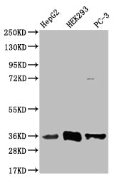 NTHL1 Recombinant Monoclonal Antibody