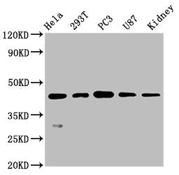 NDRG1 Recombinant Monoclonal Antibody