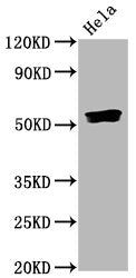 Phospho-SMAD5 (S463/S465) Antibody