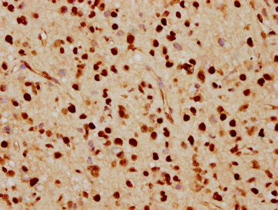 FTO Antibody