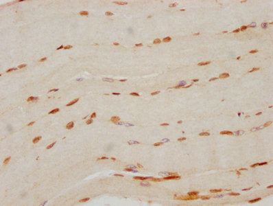 FTO Antibody