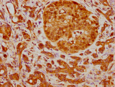 TP63 Antibody