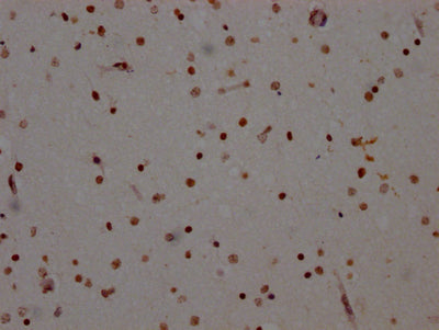 ADAR Recombinant Monoclonal Antibody