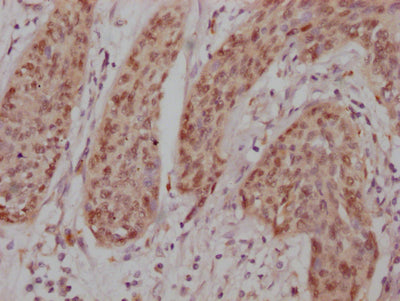 JUN Antibody