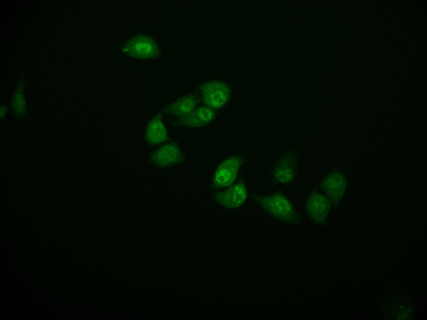 CSTB Recombinant Monoclonal Antibody