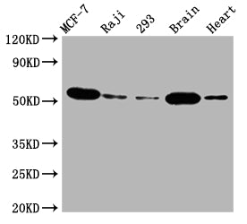 AKT1 Recombinant Monoclonal Antibody