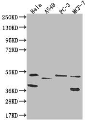 PLEKHA1 Recombinant Monoclonal Antibody