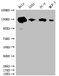 PKN2 Recombinant Monoclonal Antibody