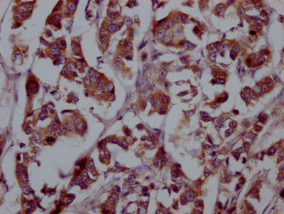 FGFR4 Recombinant Monoclonal Antibody