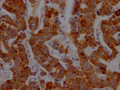 CD8A Antibody