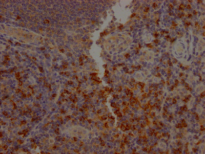 CD8A Antibody
