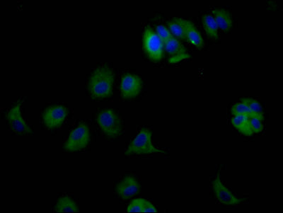 ERBB3 Recombinant Monoclonal Antibody