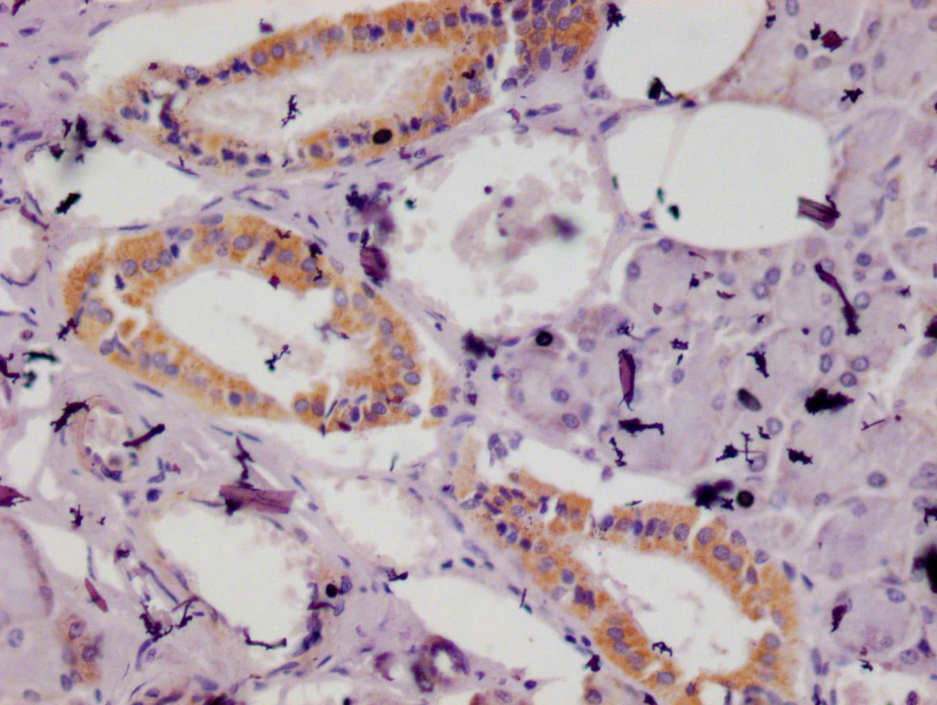 ISG15 Recombinant Monoclonal Antibody