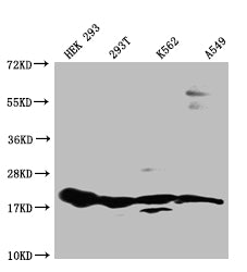 RPS19 Recombinant Monoclonal Antibody