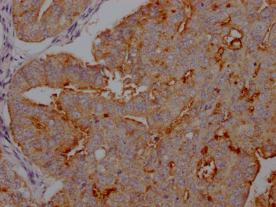 MUC16 Recombinant Monoclonal Antibody
