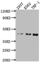 ISL1 Recombinant Monoclonal Antibody