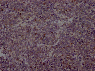 EZH2 Recombinant Monoclonal Antibody