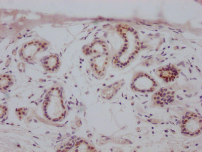 ESR1 Recombinant Monoclonal Antibody