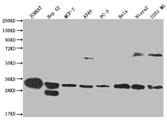 PSME1 Recombinant Monoclonal Antibody